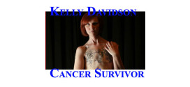 Cancer survivor takes to Facebook to prove beauty is not only skin deep